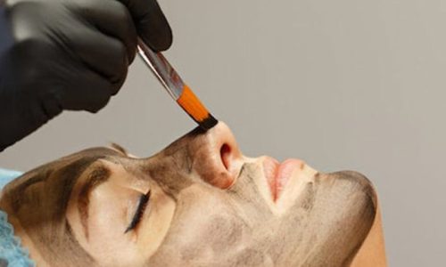 Spectra-Laser-Treatment