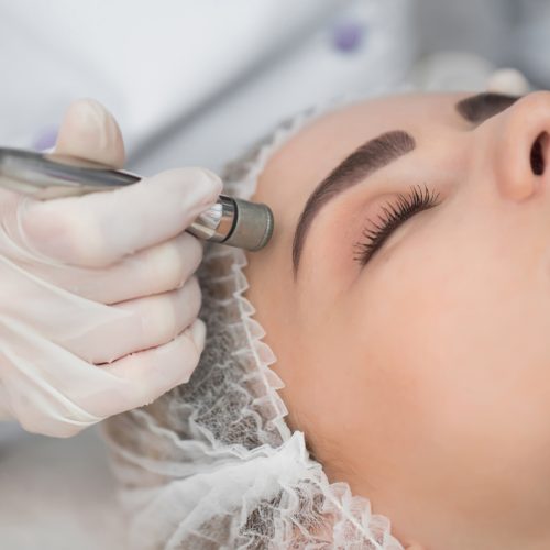 Diamond,Microdermabrasion,,Peeling,Cosmetic.,Woman,During,A,Microdermabrasion,Treatment,In